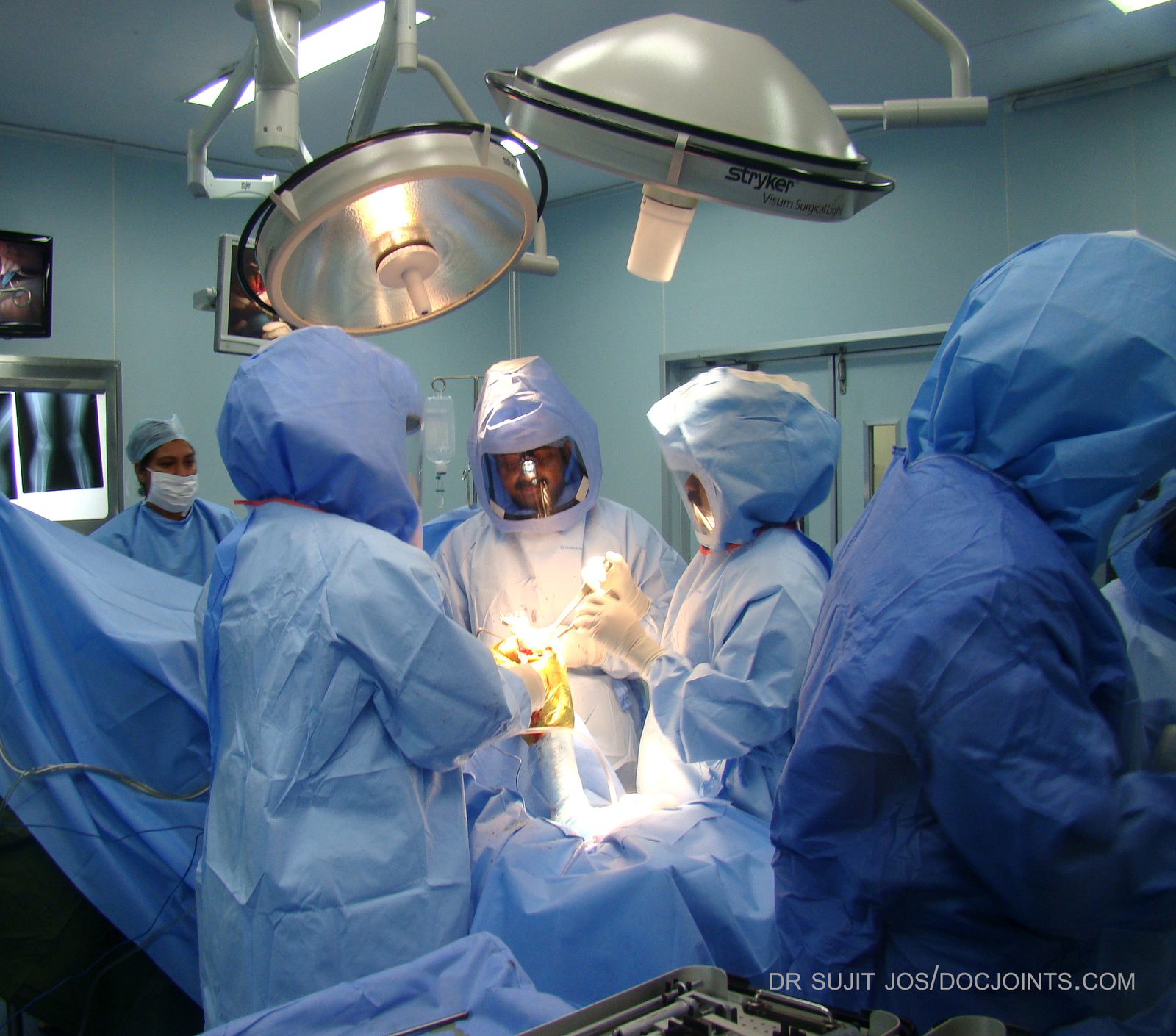 Open Reduction Internal Fixation (ORIF) Package