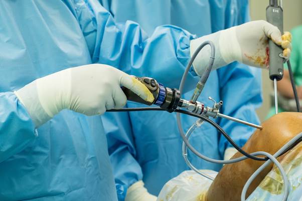 ACL & PCL Reconstruction (Both Ligaments) Package