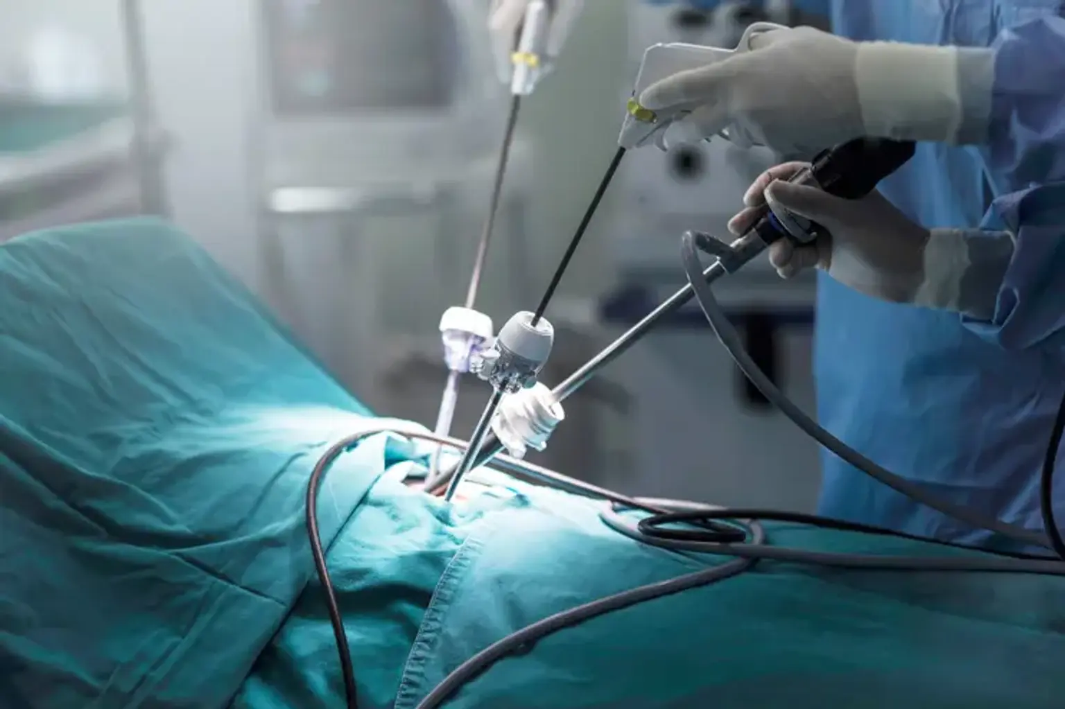 Laparoscopic Appendectomy Package