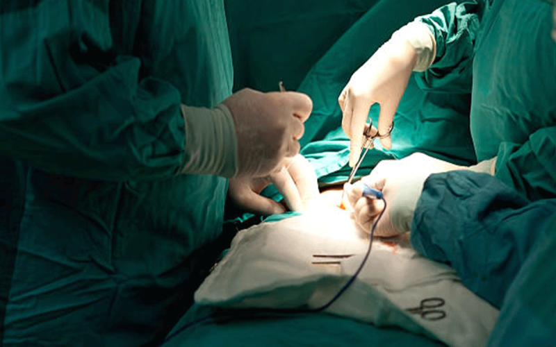 Open Appendectomy Package