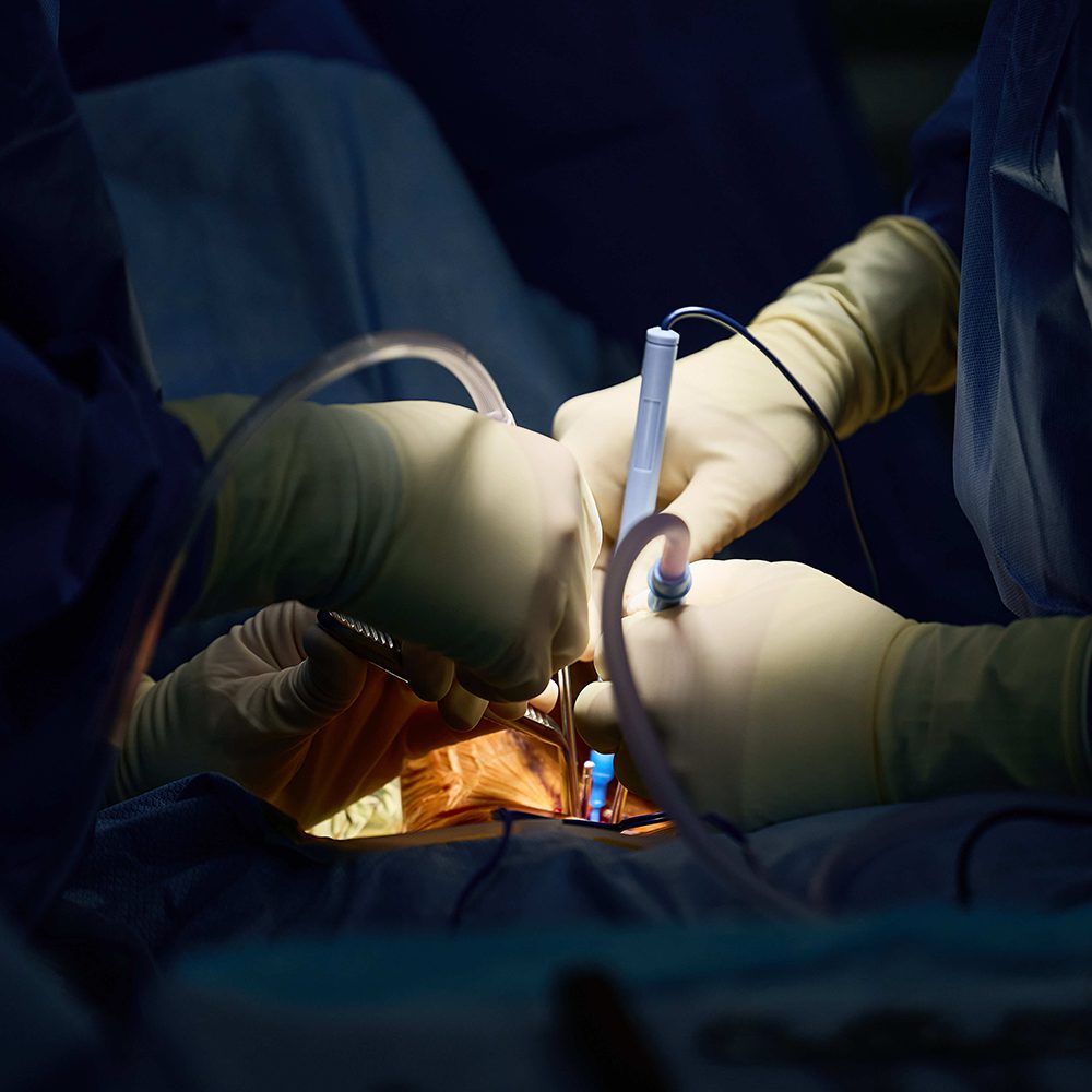 Anterior Cervical Discectomy & Fusion (ACDF) Package