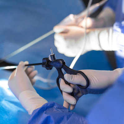 DJ Stent Removal Package