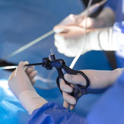 DJ Stent Removal Package