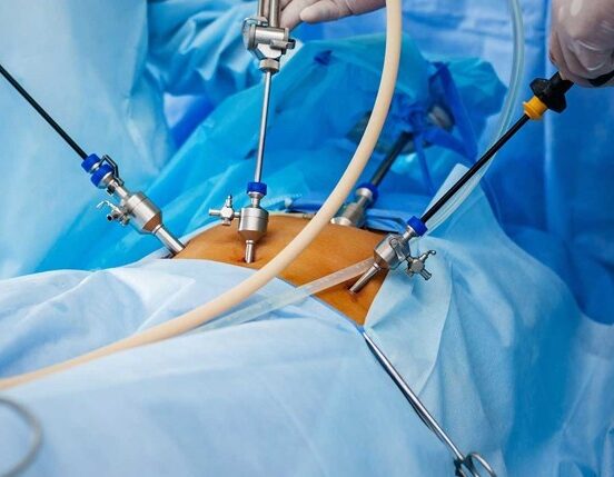 Laparoscopic Myomectomy Package