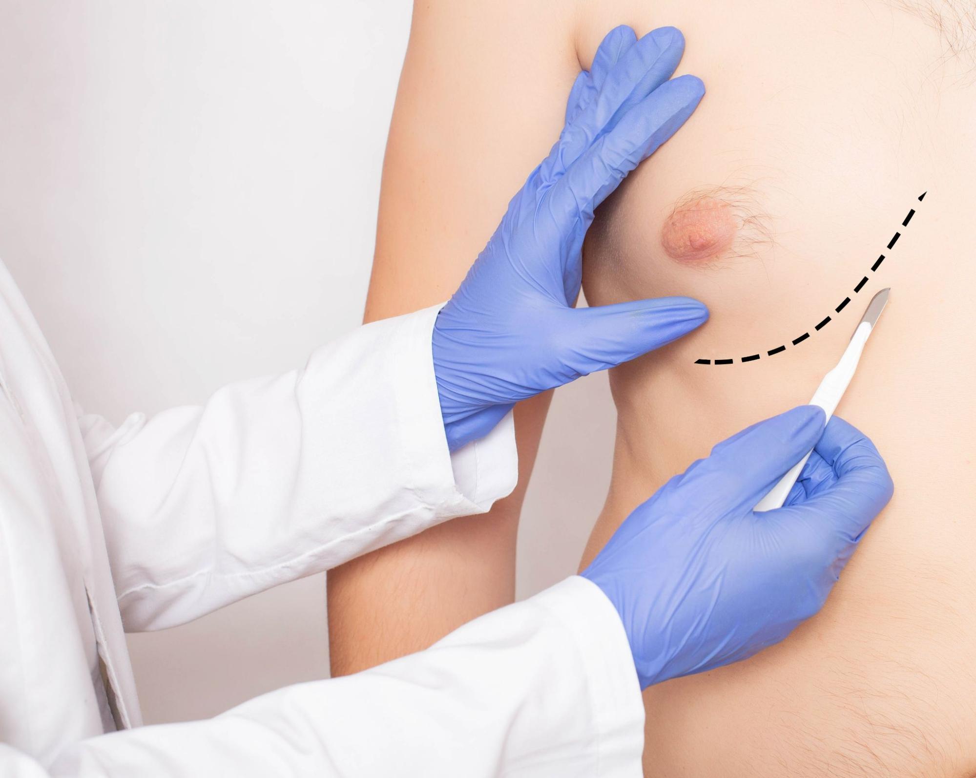 Lipo-Excision (Combination) Package