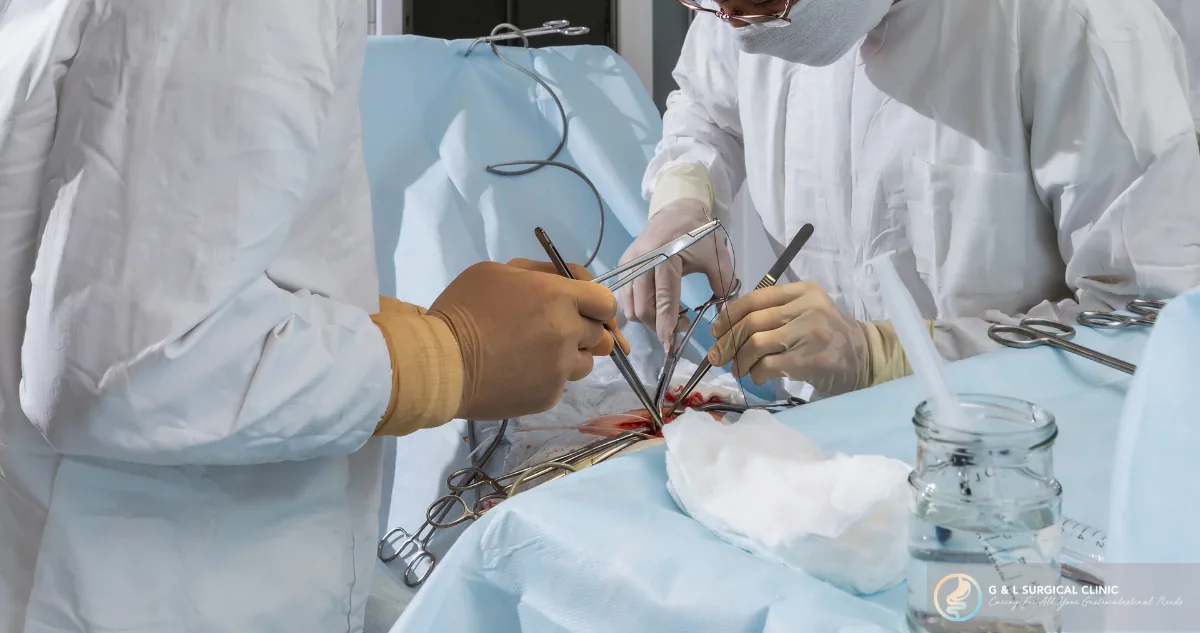 Open Mesh Repair Package (with / without Adhesiolysis)