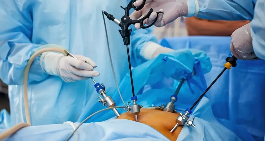 Laparoscopic Hysterectomy Package (No Adhesiolysis)