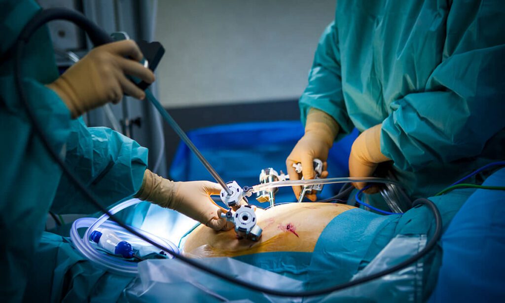 Laparoscopic Radical Hysterectomy Package (Type C1 / C2)