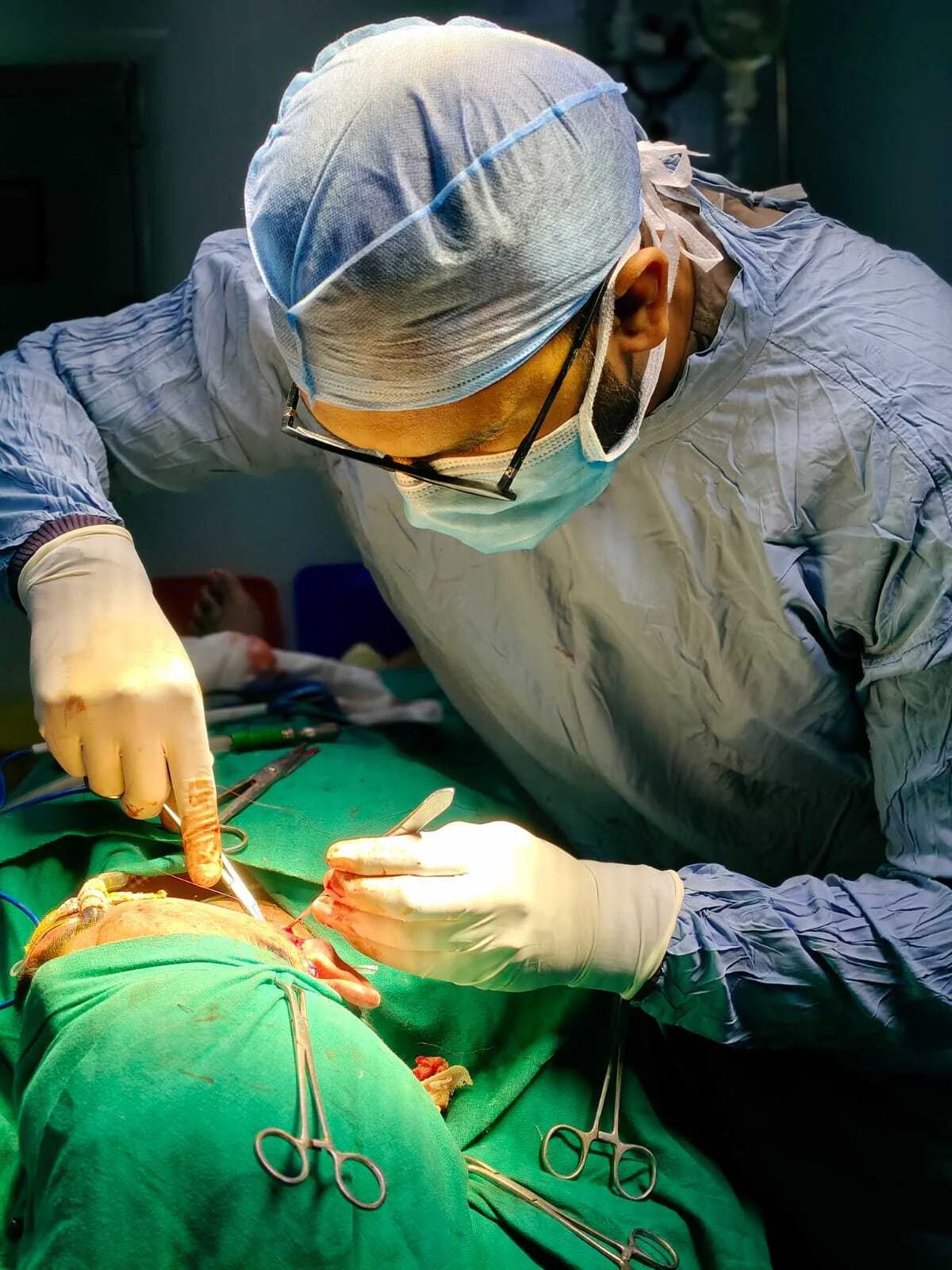 Laryngofissure with Extended Excision & Reconstruction Package