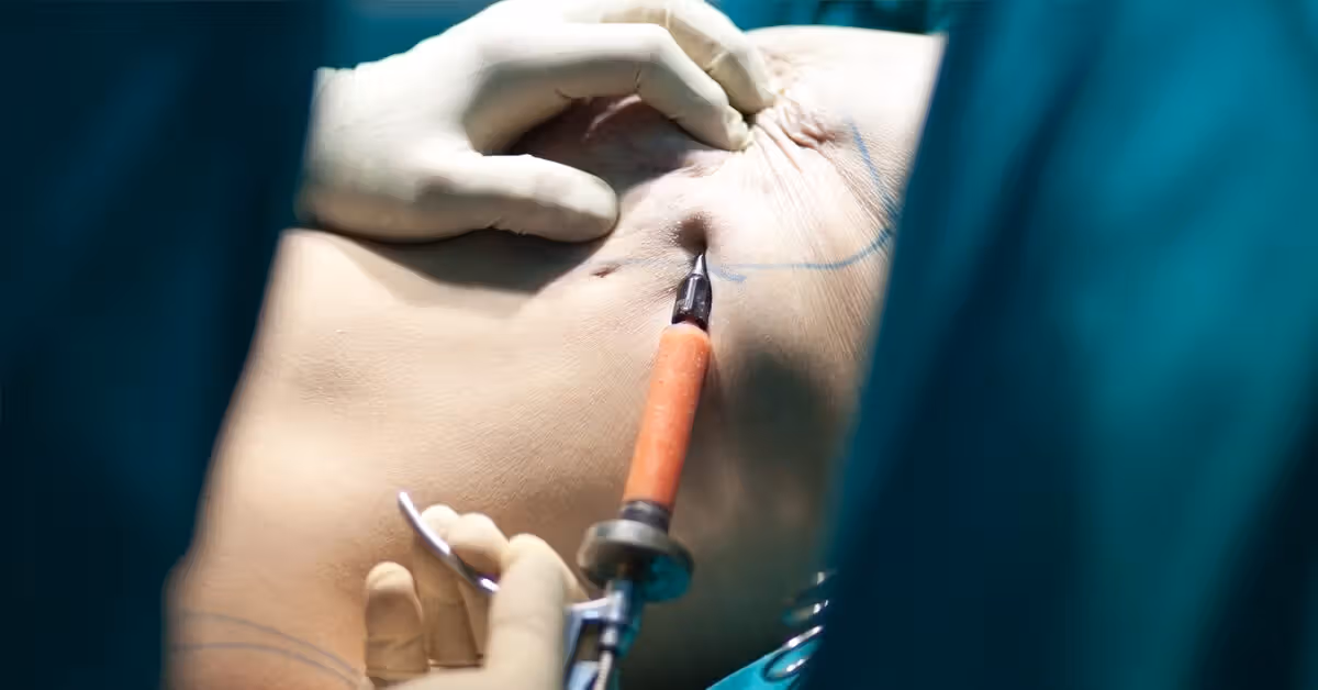 Simple Mastectomy Package