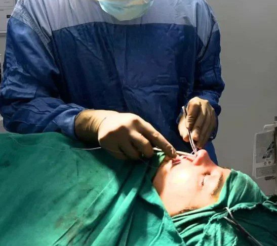 Open Reduction Internal Fixation (ORIF) Package