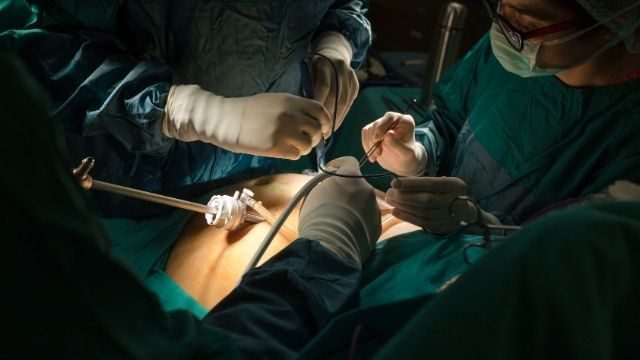 Single Fibroid Myomectomy Package