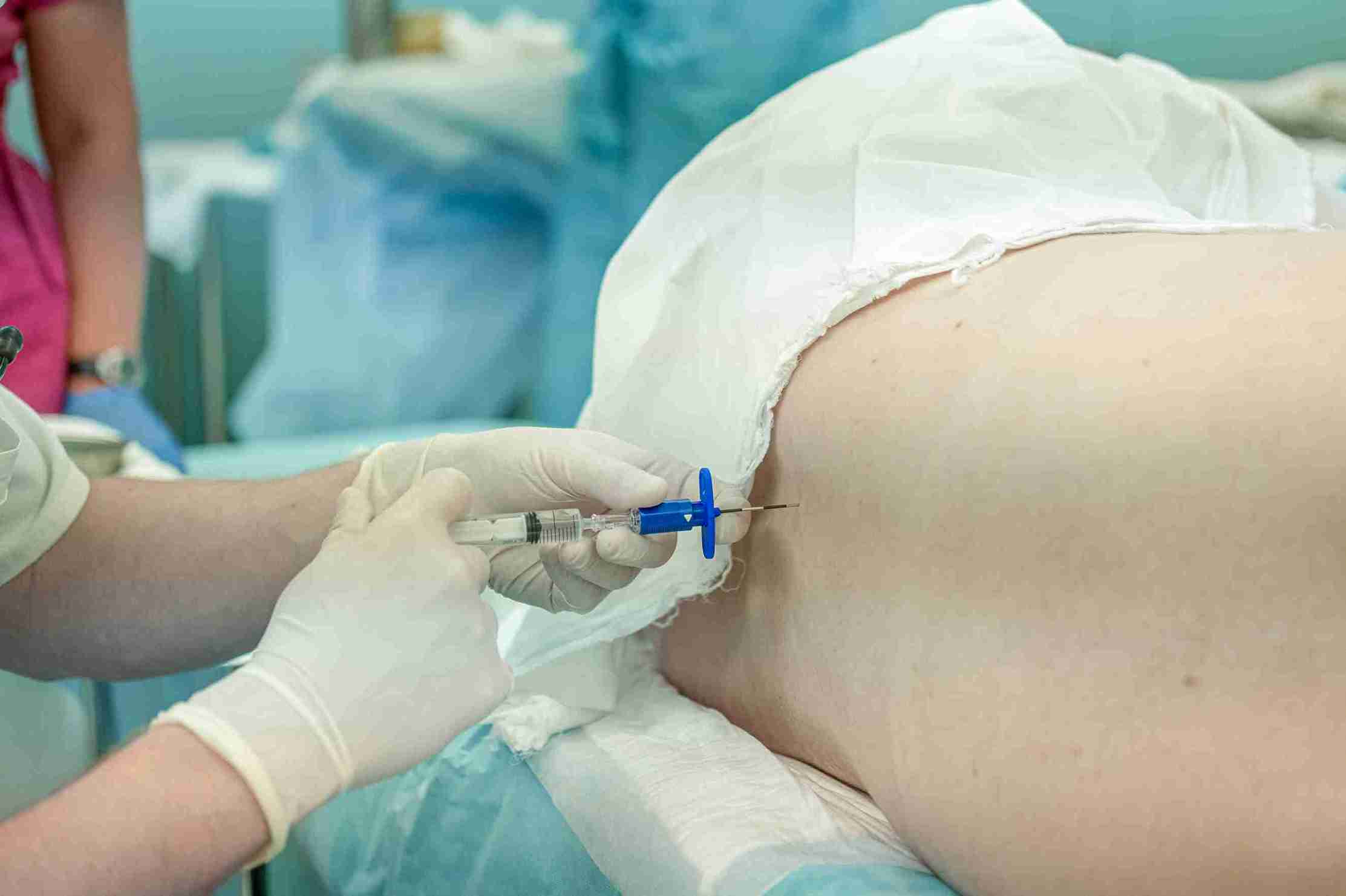 Painless (Epidural) Vaginal Delivery Package