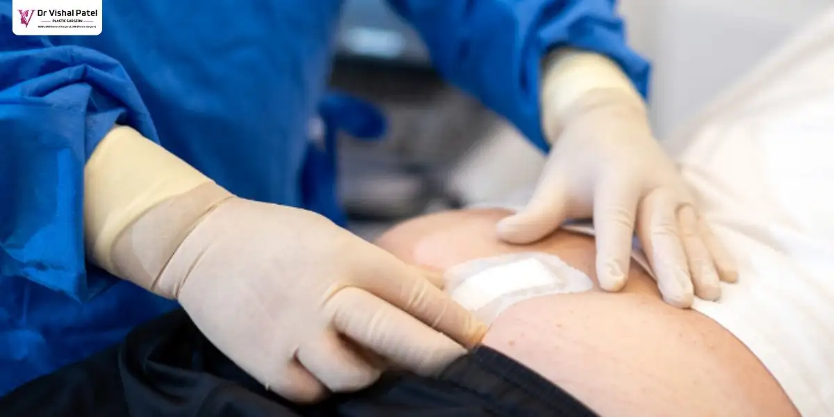Laser Pilonidoplasty Package