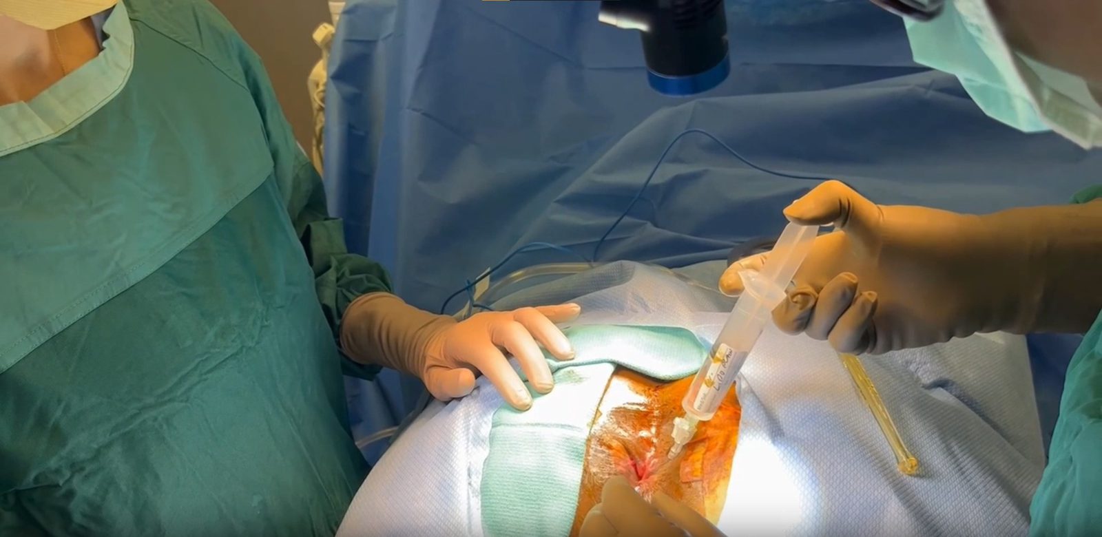 Abdominal Rectovaginal Fistula Repair Package (with Bowel Diversion)