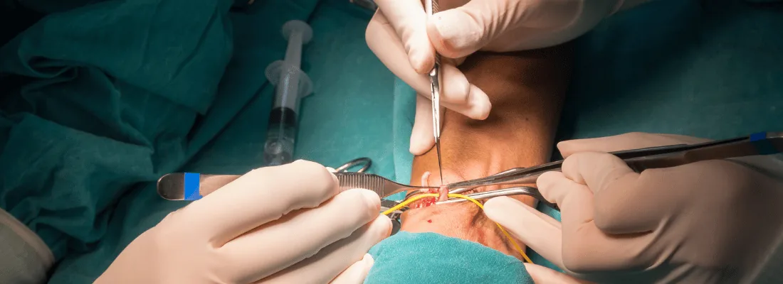 Transvaginal / Transanal Rectovaginal Fistula Repair Package