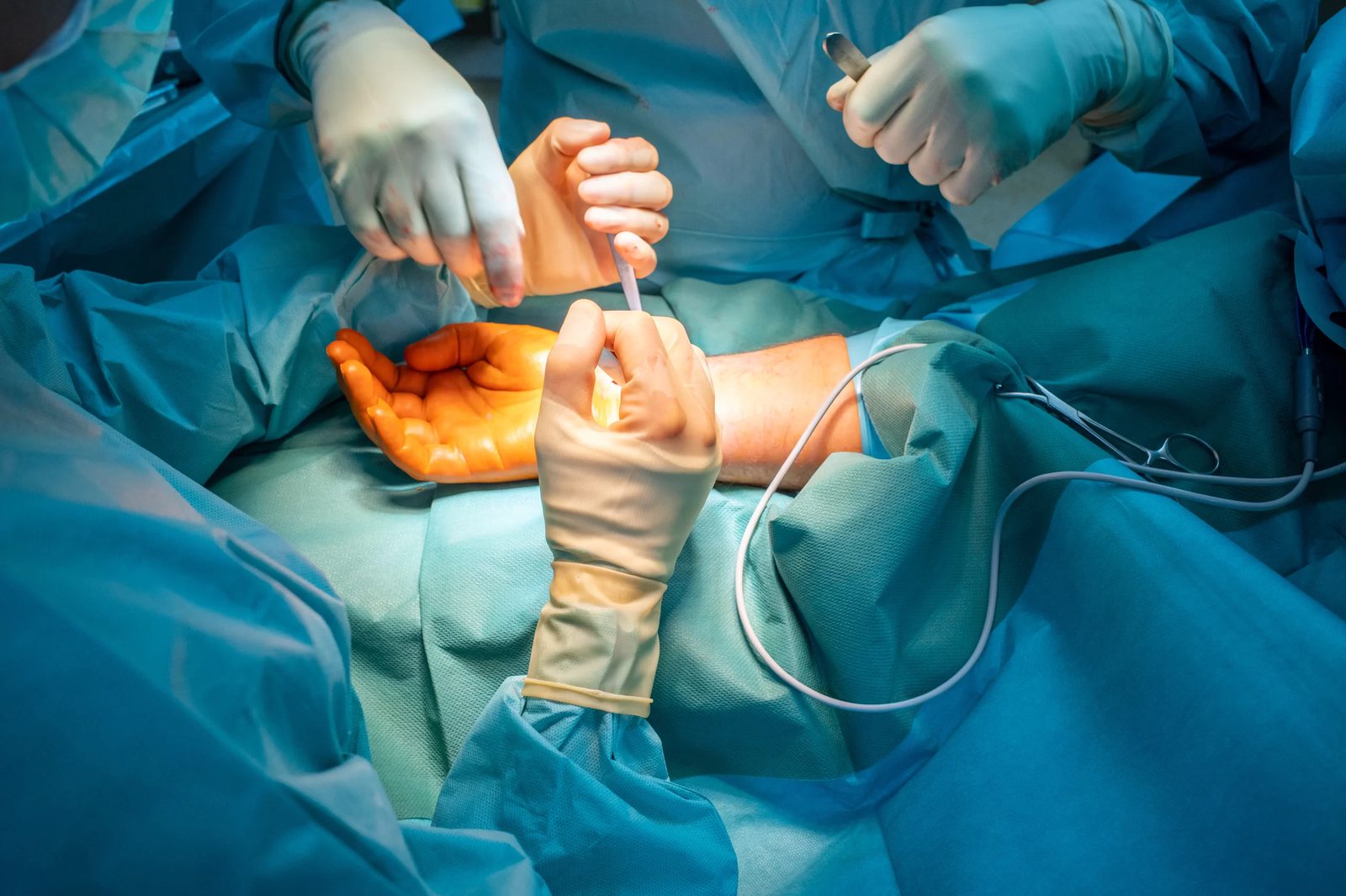 Open Reduction Fixation Package with Bone Graft