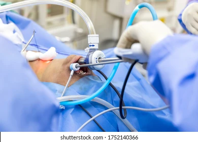 Total Thyroidectomy Package
