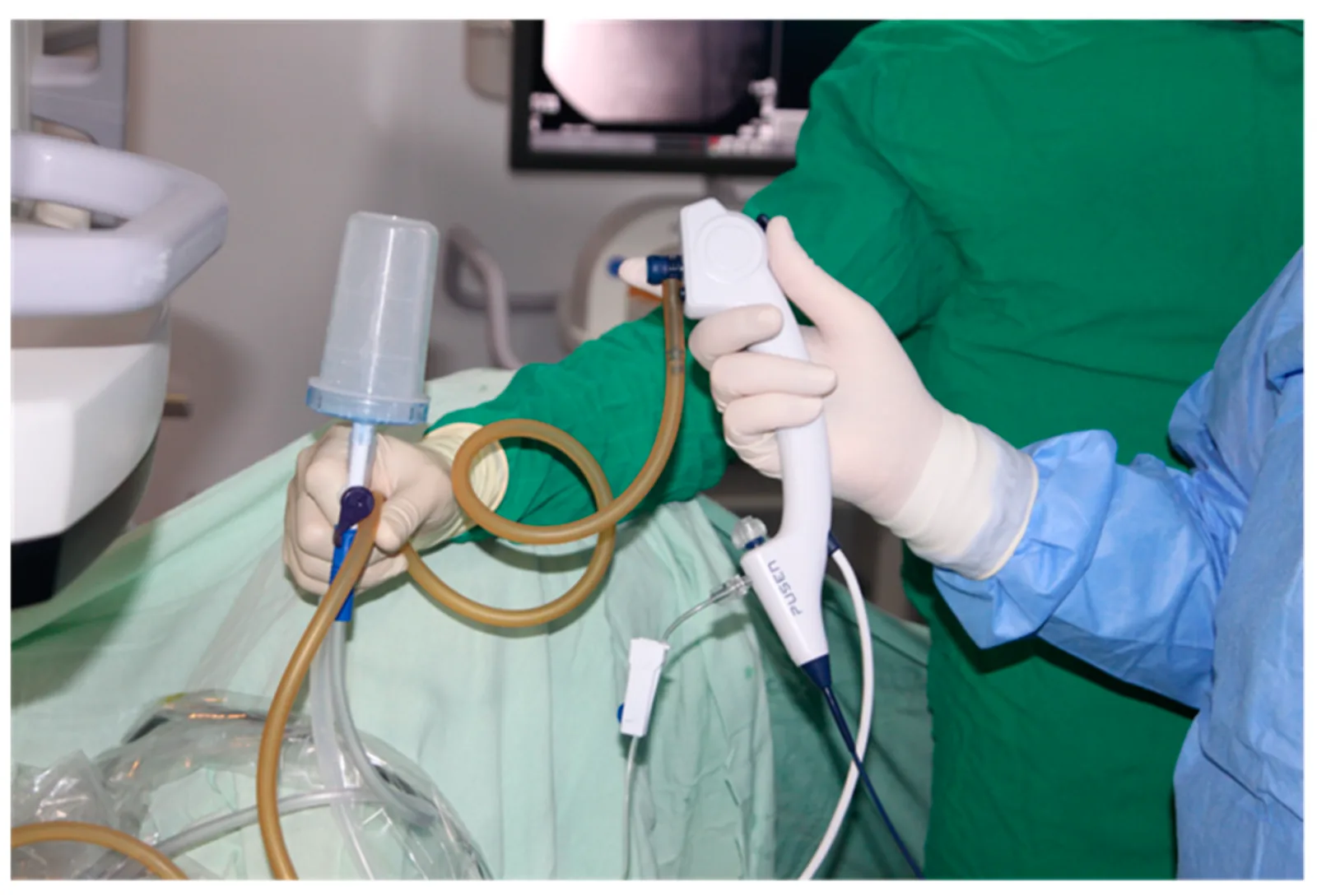 Flexible Ureteroscopy Package (RIRS)