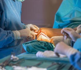 Surgical Varicose Vein Treatment Package