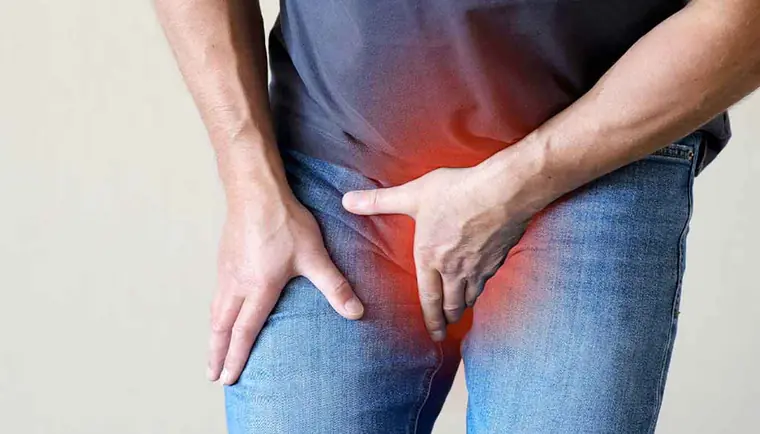 Varicocele Surgery — patient information